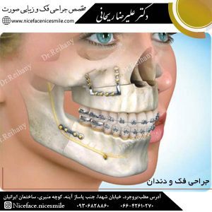 جراحی فک و دندان